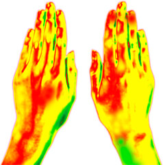 手足サーモグラフィー 約1.5℃上昇