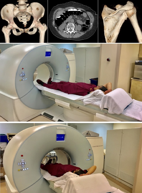 CAT Scan