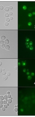 Alternative start sites in Cryptococcus