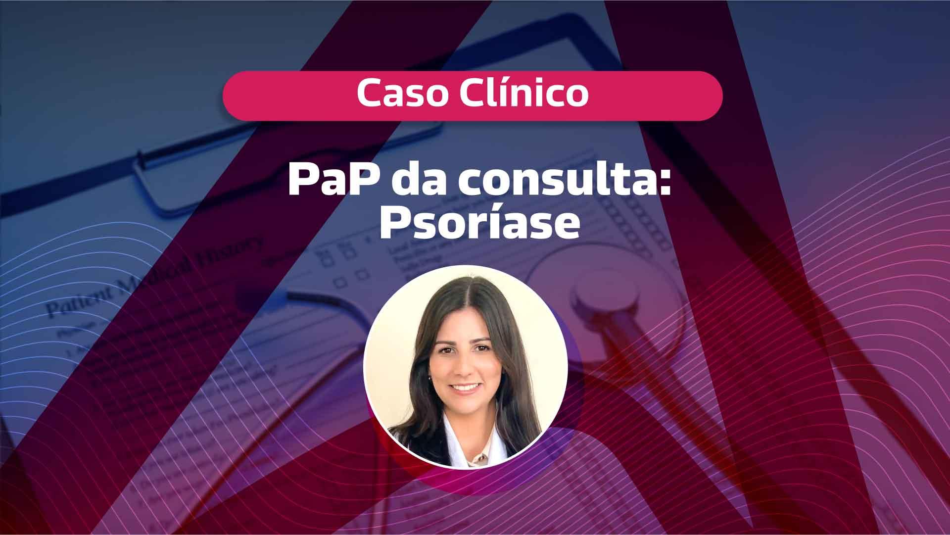 Caso Clínico: Psoríase [vídeo]