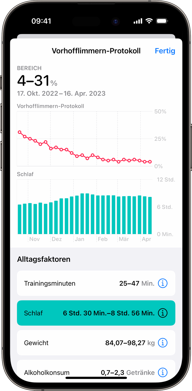 Ein iPhone mit einer Beispielkurve des Vorhofflimmern-Protokolls und dem ausgewählten Alltagsfaktor „Schlaf“