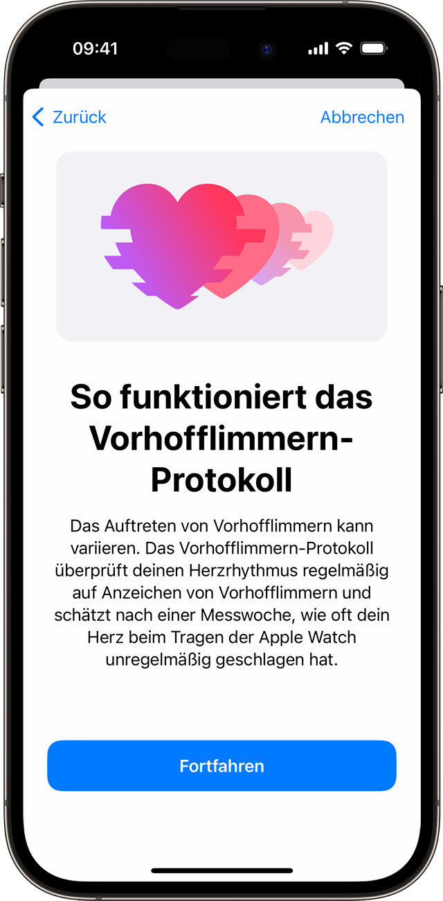 Ein iPhone, das den Setup-Bildschirm „So funktioniert das Vorhofflimmern-Protokoll“ zeigt