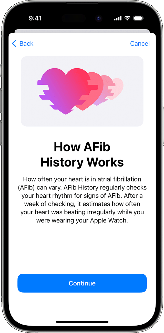 „iPhone“, kuriame rodomas sąrankos ekranas „Kaip veikia „AFib History“ (prieširdžių virpėjimo istorija)“