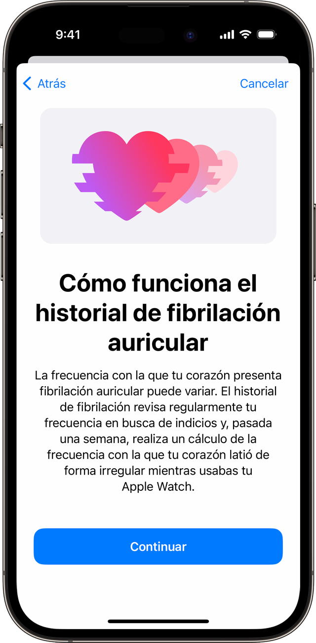 Un iPhone en el que se muestra la pantalla de configuración Cómo funciona el historial de fibrilación auricular