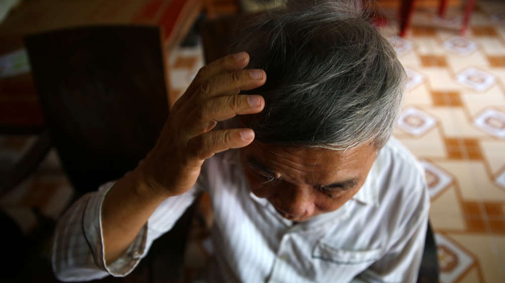 Wounded veteran Le Van Nam shows the 3cm head wound he received during the Vietnam War. Nam, a former lieutenant in the North Vietnamese army, is one of an unknown number of veterans who suffer from mental illnesses in Vietnam. Experts say the country's mental health system should take a more preventive and holistic approach [Na Son Nguyen] [Daylife]