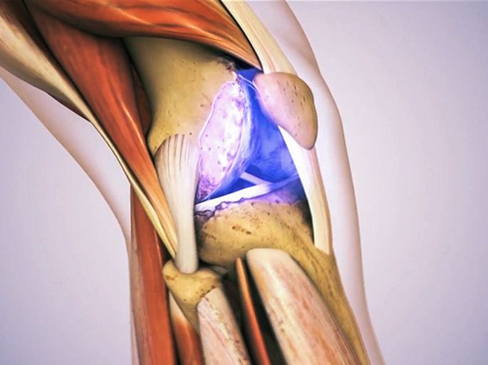 غضاريف البقر.. علاج بديل لمرضى التهاب المفاصل