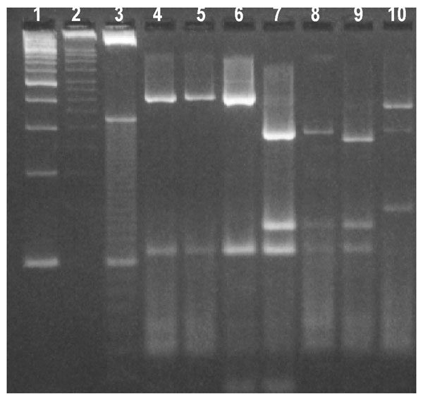 Restriction profiles obtained after digestion of polymerase chain reaction products from the Cryptosporidium oocyst wall protein locus with Rsa I. Lanes 1- 3-, 100-, 50-, and 10-bp ladder molecular weight markers; lanes 4 and 6, bovine genotype 2 isolates; lanes 7 and 8, human genotype 1 isolates; lane 9, cervine genotype isolate MH205; and lane 10, C. meleagridis isolate CS33