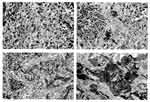 Thumbnail of Sections of spleen from Ebola virus (EBOV)-infected animals. Top left, BALB/c mouse, note absence of polymerized fibrin (phosphotungstic acid [PTA] hematoxylin, original magnification X400). Field representative of five of five mice tested. Top right: guinea pig. Note discreet foci of polymerized fibrin (arrows) (PTA hematoxylin, original magnification X400). This field shows infrequent fibrin deposits; most fields in five of five animals examined showed no evidence of polymerized f