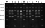 Thumbnail of Figure 5. Ribotyping of Streptococcus suis serotype 2 isolates by PvuII restriction. Lane 1, deceased pig isolate SC5; lane 2, deceased pig isolate SC16; lane 3, patient isolate SC154; lane 4, patient isolate SC160; lane 5, patient isolate SC175; lane 6, patient isolate SC179; lane 7, patient isolate SC204; lane 8, patient isolate SC206; M, molecular size standard.