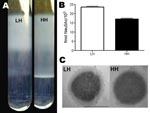 Thumbnail of A) Buoyant density analysis of the low hemolytic (LH) and high hemolytic (HH) strains, exhibiting lower and higher buoyant density, respectively. B) Quantification of group B streptococci sialic acids expressed as fmol N-acetylneuraminic acid/1,000 CFUs of the LH and HH phenotypes. Error bars indicate SEM. C C) Transmission electron microscopy of LH and HH phenotypic variants.