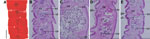 Thumbnail of Diphyllobothriid samples examined in the present study, China, 2008–2012. A) Proglottids stained with acetic acid–carmine from case-patient 12. B–E) Sagittal sections of proglottids stained with hematoxylin-eosin from case-patients 16–19. cs, cirrus sac; ut, uterus; sv, seminal vesicle; ov, ovary; ga, genital atrium. Scale bar in panel A represents 2 mm; scale bars in panels B–E represent 500 μm.