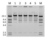 Thumbnail of EcoRI restriction profile of fosA3-carrying plasmids from a woman in Pennsylvania, USA, who  was colonized with fosfomycin-resistant Escherichia coli. Lanes M, lambda DNA/HindIII marker; lane 1, February 2011 (YD472); lane 2, March 2008; lane 3, June 2007 (ECRB1); lane 4, April 2008; lane 5, January 2008. Values on the left are in kilobases.