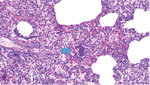 Bacterial embolus (arrow) caused by group B Streptococcus infection in a lung section of a pig (Sus scrofa) from a pig farm in the Modena Province, northern Italy. Group B Streptococcus was detected in the kidney, liver, and heart, indicating disseminated infection caused by septicemia. Hematoxylin–eosin staining; original magnification ×10.