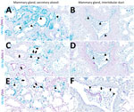 Infected region of the mammary gland from a US dairy cow infected with highly pathogenic avian influenza A(H5N1) virus, showing IAV-Np (teal chromogen), individually duplexed with MAL-I (magenta chromogen), MAL-II (magenta chromogen), and SNA (magenta chromogen) using chromogenic staining. Representative images IAV-Np/MAL-I (A, B), IAV-Np/MAL-II (C, D), and IAV-Np/SNA (E, F) in infected mammary gland and interlobular duct are shown. Strong intracytoplasmic and intranuclear immunoreactivity with IAV-Np was observed within the glandular epithelium of the mammary alveolus and interlobular ducts (arrowheads) with no substantial MAL-I labeling (A, B). Scant, multifocal, apical, punctate MAL-II labeling was observed in degenerative mammary gland epithelial cells (arrows) with strong, intranuclear, and intracytoplasmic immunoreactivity for IAV-Np (arrowheads) (C). Interlobular ductal epithelium exhibits strong, multifocal intranuclear and intracytoplasmic immunoreactivity to IAV-Np in attenuated and sloughed cells (arrowheads) with no substantial epithelial MAL-II detected (D). Strong, multifocal, punctate, apical labeling with SNA in attenuated or degenerative epithelial cells (arrows) with strong, intranuclear, and intracytoplasmic immunoreactivity for IAV-Np (arrows) was observed within mammary gland epithelium (E). Scant, multifocal, delicate, apical labeling for SNA (arrows) within ductal epithelium with strong, intranuclear, and intracytoplasmic immunoreactivity within sloughed, intraluminal epithelial cells for IAV-Np (arrowheads) was observed in an interlobular duct (F). Scale bars indicate 200 μm. IAV-Np, influenza A virus nucleoprotein; MAL, Maackia amurensis lectin; SNA, Sambucus nigra lectin.