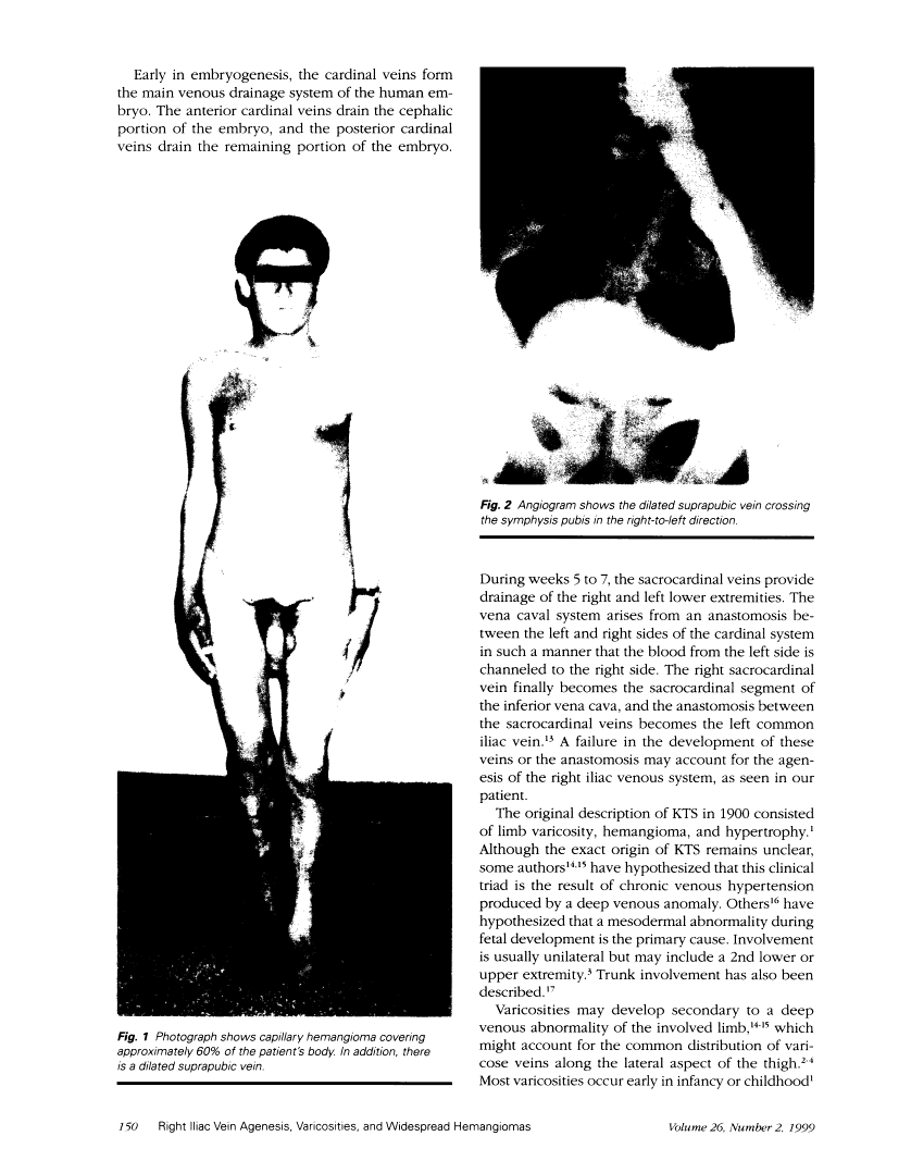 icon of scanned page 150