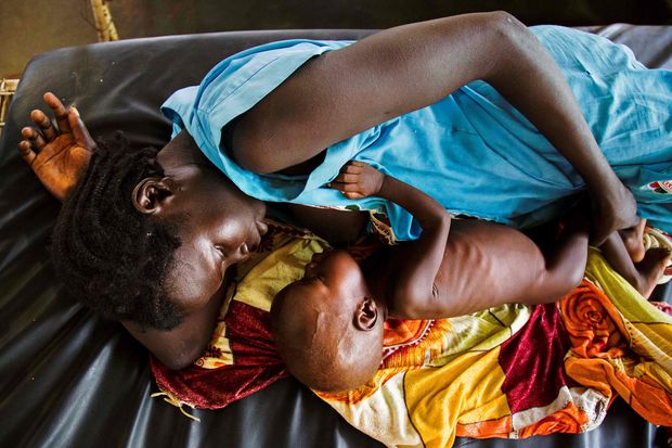  (FILES) This file photo taken on October 11, 2016 shows a mother breastfeeding her child who suffers acute malnutrition at the clinic run by Doctors Without Borders (MSF) in Aweil, northern Bahr al-Ghazal, South Sudan. South Sudan's government said on February 20, 2017, that the country's over three-year war has led to famine in parts of the nation, while nearly half the population was going hungry. / AFP PHOTO / ALBERT GONZALEZ FARRAN ORG XMIT: 3240