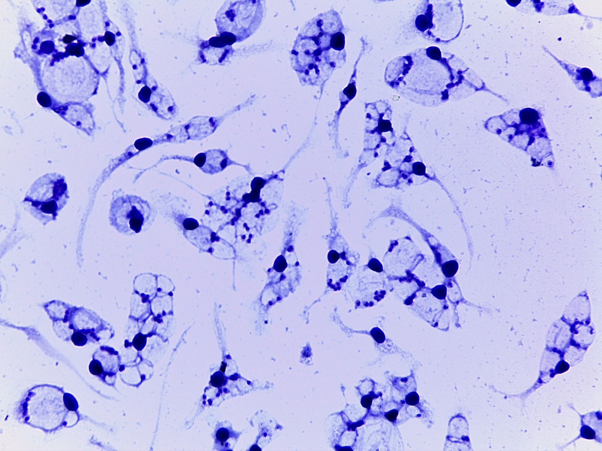 Resistance to the main drugs used in Brazil against <i>Leishmania</i> is found in parasite infecting cutaneous leishmaniasis patient