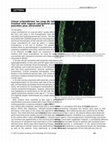 Research paper thumbnail of Tuberous sclerosis associated with multiple speckled lentiginous nevi