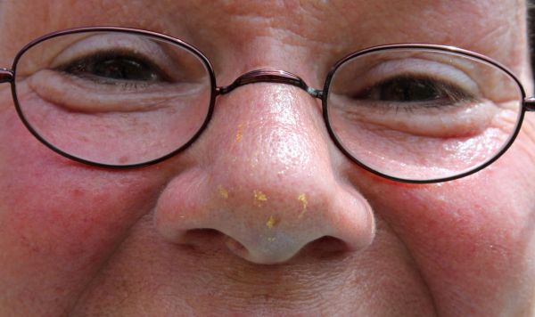 nose,skin,pollen,glasses,face,sniffing