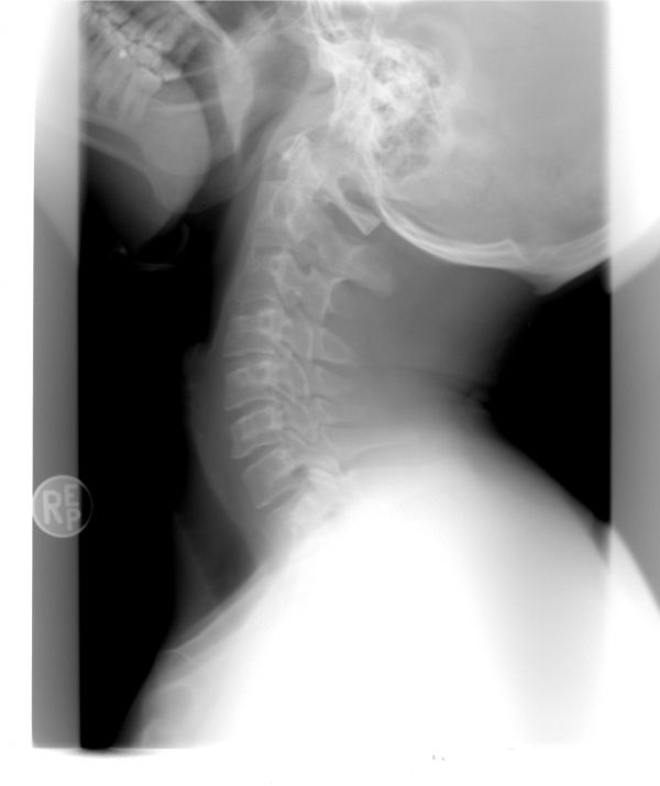 Hand,Schwarz und weiß,Kofferraum,einfarbig,Arm,Ohr