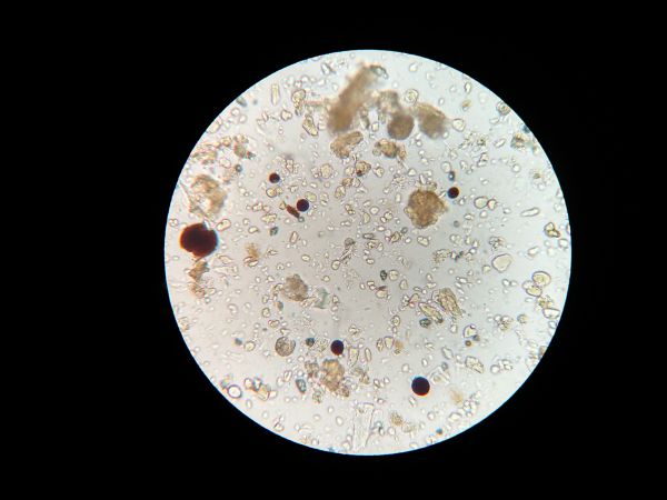 Microbios del suelo,Luna,circulo,forma,microscopio,Objeto astronómico