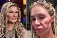 real-housewives-brandi-glanville-unrecognizable-health-condition 