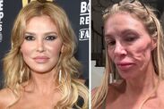 real-housewives-brandi-glanville-face-moroccan-parasites