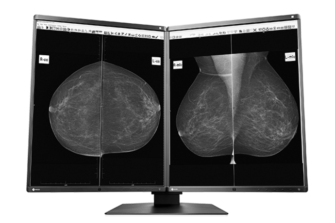 Produktbild GX560-MD RadiForce