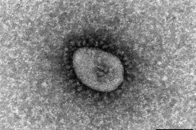 国立感染症研究所で分離に成功した新型コロナウイルスのオミクロン株の電子顕微鏡写真＝国立感染症研究所提供