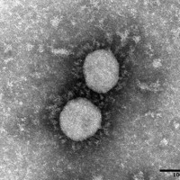 新型コロナウイルスのデルタ株＝国立感染症研究所提供