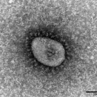 新型コロナウイルスのオミクロン株＝国立感染症研究所提供