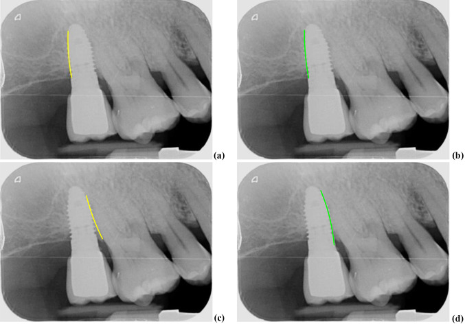 Fig. 11