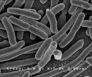 e-coli under an electron microscope