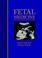 Cover of: Fetal Medicine