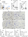 Meningeal T cells and B cells are enriched in MS and topographically linked