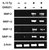 Effect of GM-6001 on IL-13–induced MMP mRNA. One-month-old nontransgenic an