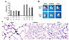 Effects of cysteine protease inhibitors on IL-13–induced emphysema. One-mon