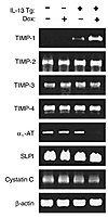 Effect of IL-13 on respiratory antiproteases. RT-PCR was used to compare th