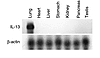 Organ specificity of IL-13 expression. CC10-rtTA-IL-13 mice were given dox