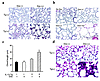 Characteristics of CC10-rtTA-IL-13 mice. (a) Compares H&E-stained lungs fro