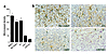 Determination of the MVD of pulmonary tumor nodules in DNA-treated nude mic