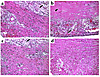 Comparison of histology of cardiac allografts. (a) CX3CR1+/+ recipients, (c