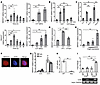 SNHG17 expression was increased by H. pylori infection.