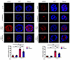 SNHG17 knockdown decreased the accumulation of DSBs upon H. pylori infectio