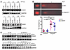 SNHG17 knockdown decreased the accumulation of DSBs upon H. pylori infectio