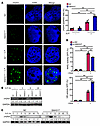 SNHG17 expression increased the accumulation of DSBs upon H. pylori infecti