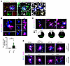 Nucleic acid–containing Aβ plaques engage microglia in AD brain.