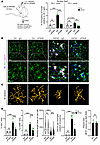 IFN blockade dampens microglial activation in AD model.