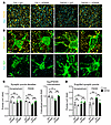 IFN blockade rescues synapse loss in AD model.