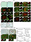 Podocyte PD-1 immunostaining and transcripts.